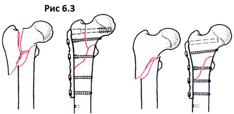 : http://osteosientes.narod2.ru/proksimaln/162.png?rand=55534550293546